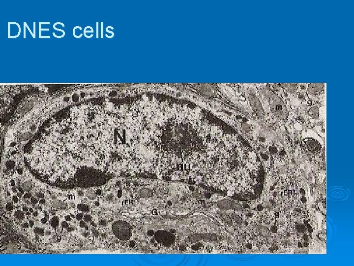 DNES cells 