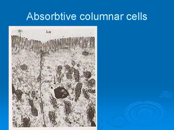 Absorbtive columnar cells 