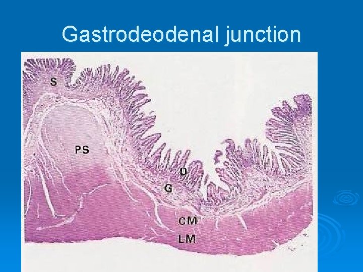 Gastrodeodenal junction 