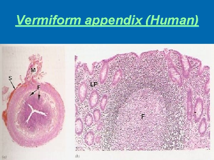 Vermiform appendix (Human) 