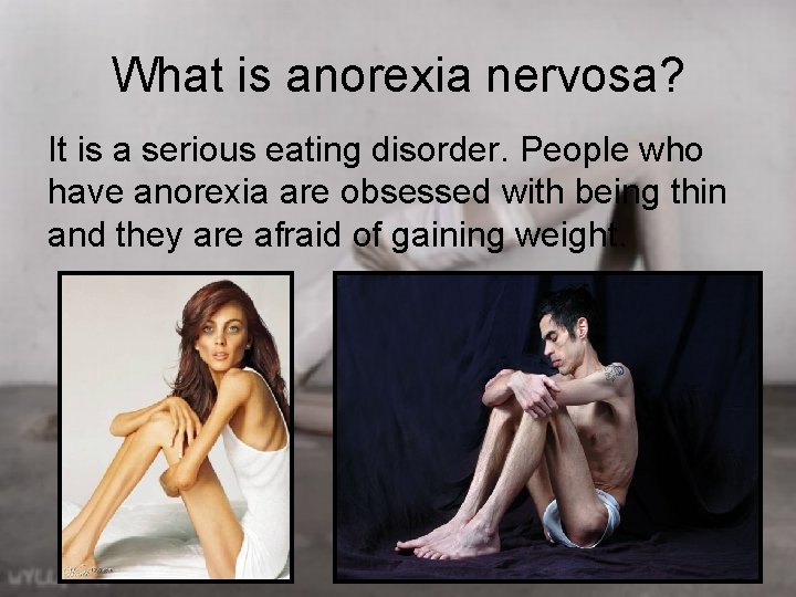 What is anorexia nervosa? It is a serious eating disorder. People who have anorexia