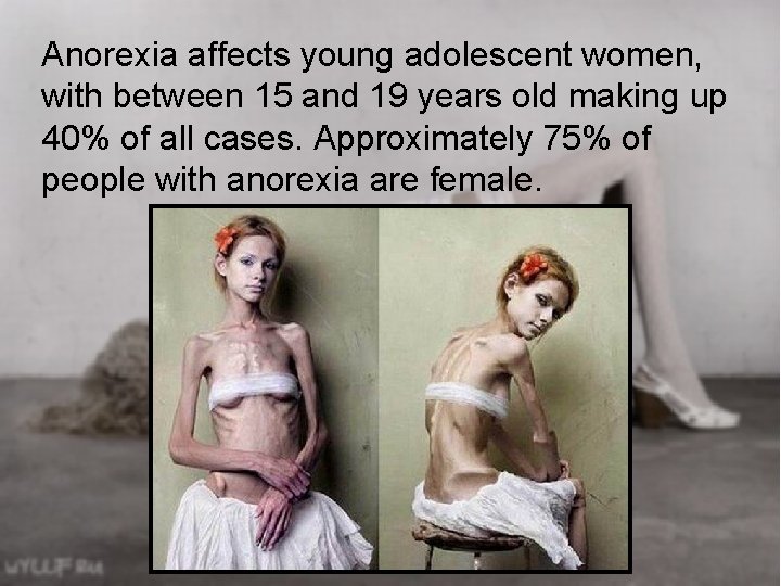 Anorexia affects young adolescent women, with between 15 and 19 years old making up Anorexia affects young adolescent women, with between 15 and 19 years old making up
