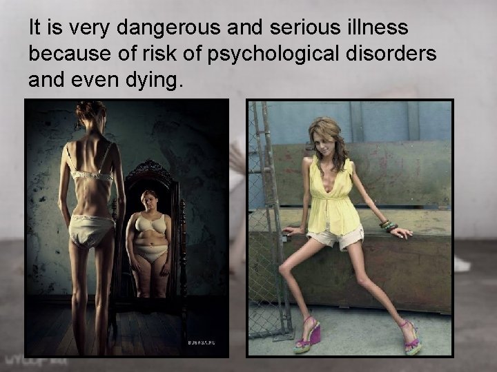 It is very dangerous and serious illness because of risk of psychological disorders and It is very dangerous and serious illness because of risk of psychological disorders and