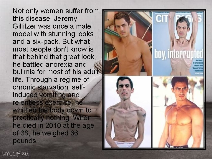 Not only women suffer from this disease. Jeremy Gillitzer was once a male model