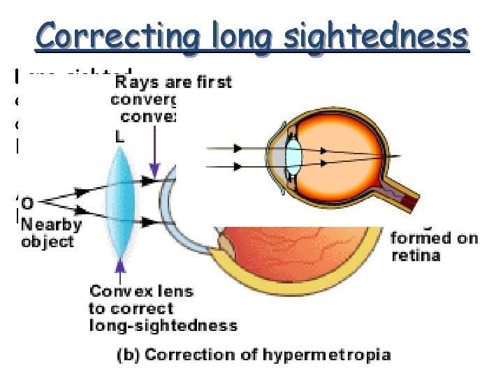 Correcting long sightedness Long sighted – eyeball too short or wrong shaped lens Add