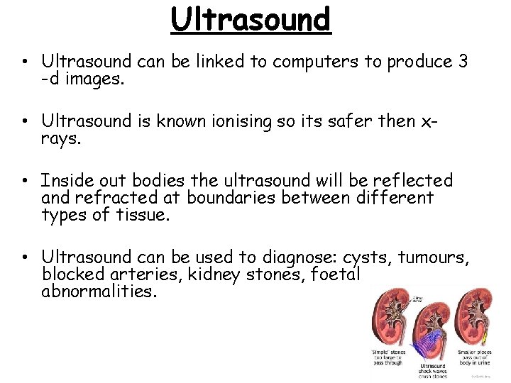 Ultrasound • Ultrasound can be linked to computers to produce 3 -d images. •