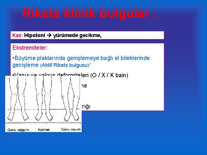 Rikets klinik bulgular : Kas Hipotoni yürümede Sırt: : Skolyoz , kifoz , lordoz