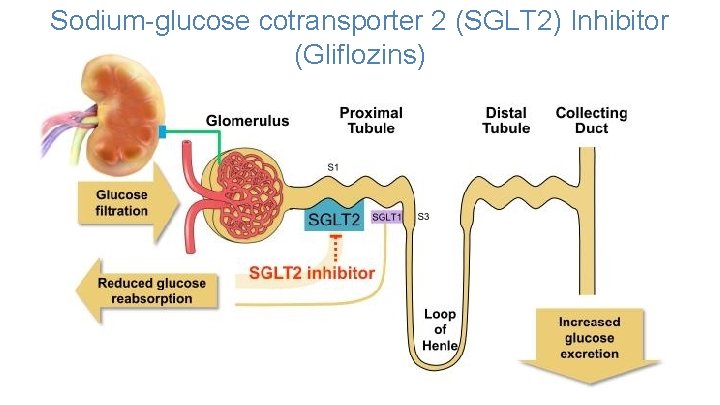 Sodium-glucose cotransporter 2 (SGLT 2) Inhibitor (Gliflozins) 