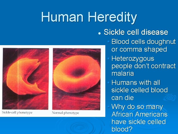 Human Heredity l Sickle cell disease • Blood cells doughnut or comma shaped •