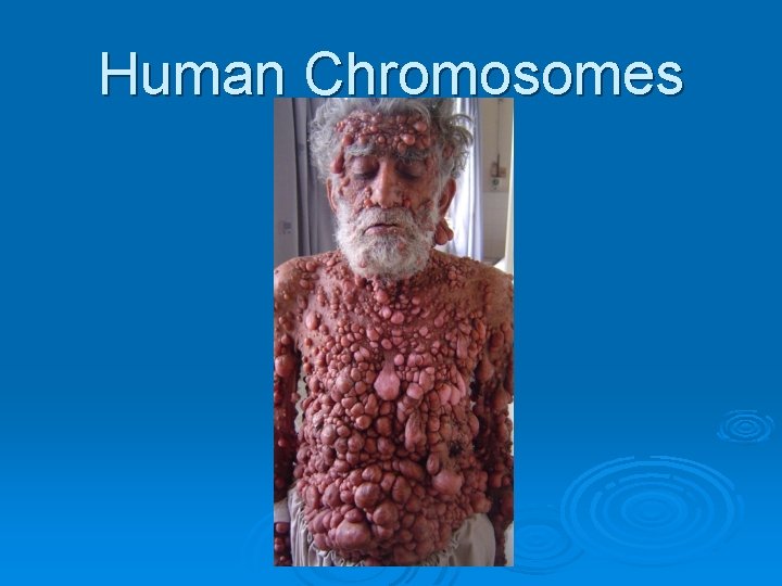 Human Chromosomes 