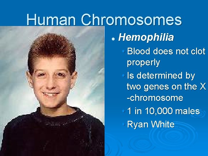 Human Chromosomes l Hemophilia • Blood does not clot properly • Is determined by