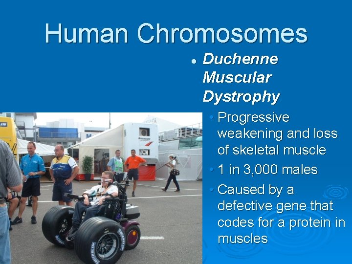 Human Chromosomes l Duchenne Muscular Dystrophy • Progressive weakening and loss of skeletal muscle