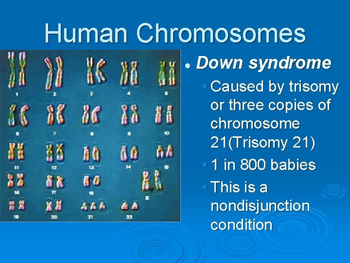 Human Chromosomes l Down syndrome • Caused by trisomy or three copies of chromosome