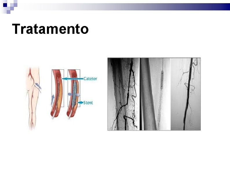 Tratamento 