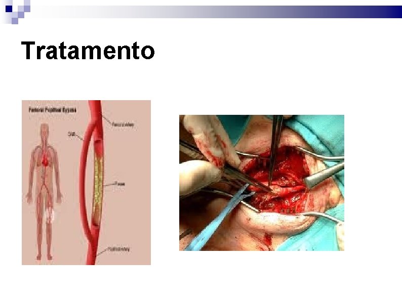 Tratamento 