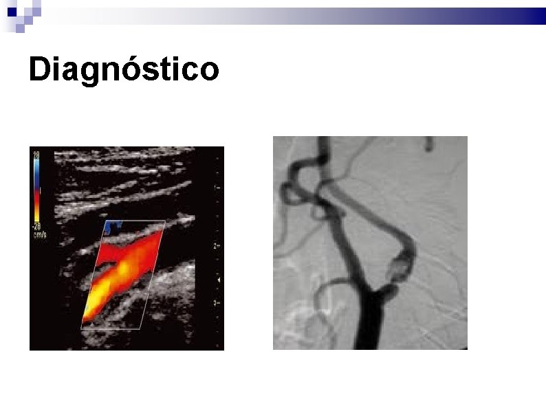 Diagnóstico 