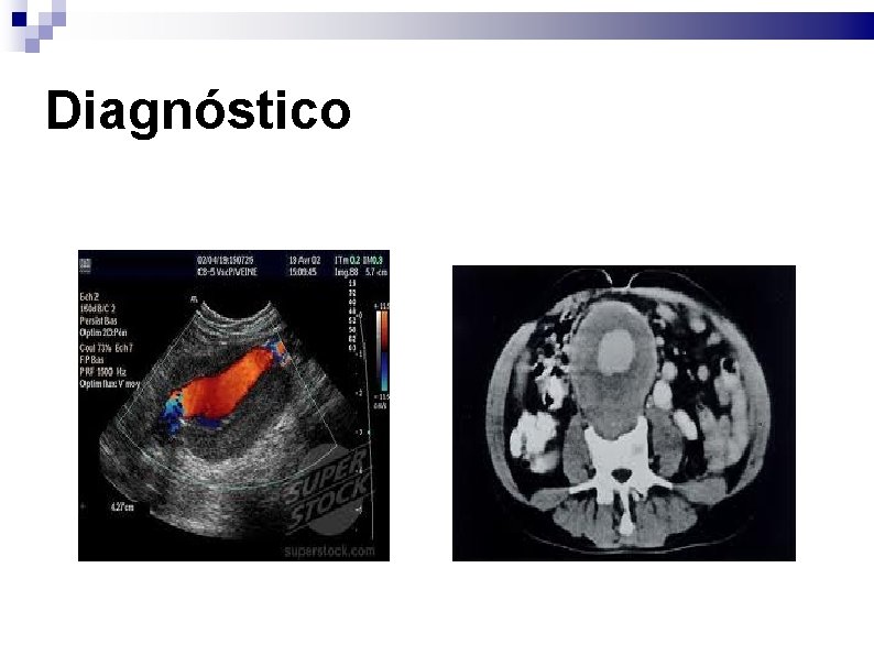 Diagnóstico 