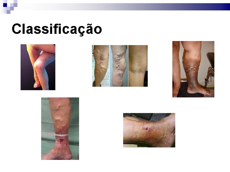 Classificação 