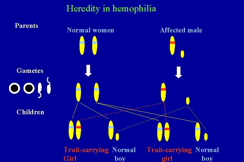 Heredity in hemophilia Parents Normal women Affected male Gametes Children Trait-carrying Normal Girl boy Heredity in hemophilia Parents Normal women Affected male Gametes Children Trait-carrying Normal Girl boy