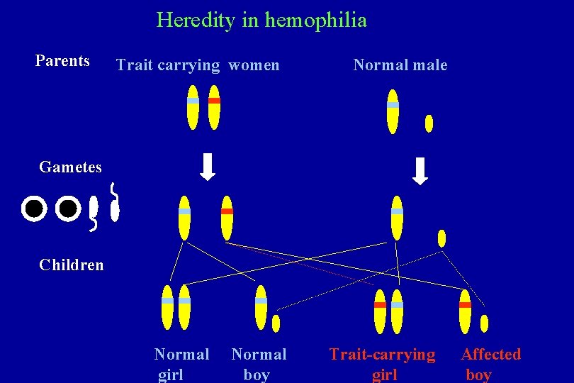 Heredity in hemophilia Parents Trait carrying women Normal male Gametes Children Normal girl Normal