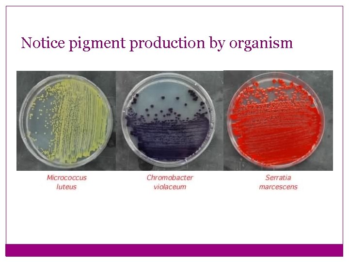 Notice pigment production by organism 