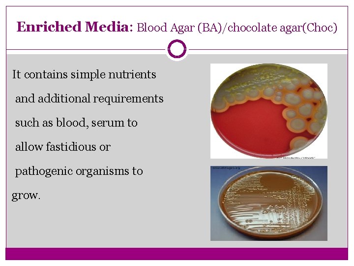 Enriched Media: Blood Agar (BA)/chocolate agar(Choc) It contains simple nutrients and additional requirements such