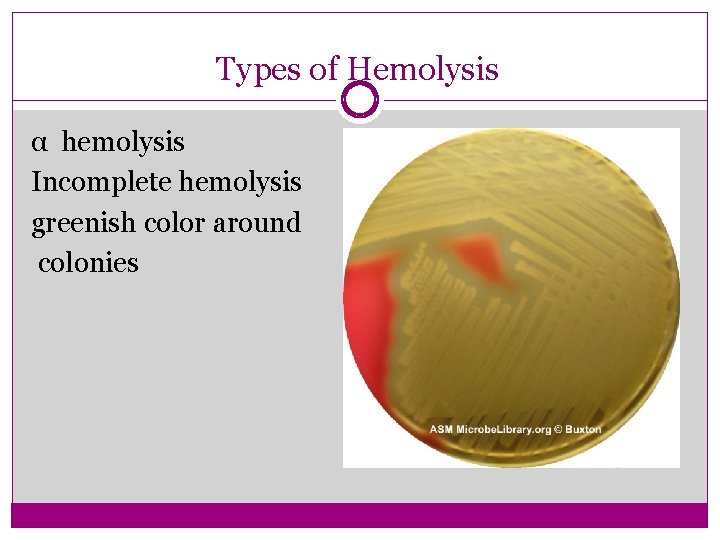 Types of Hemolysis α hemolysis Incomplete hemolysis greenish color around colonies 