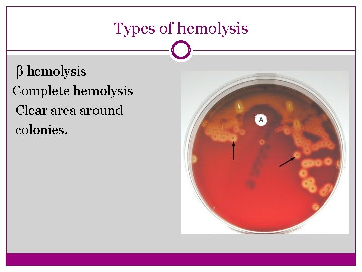 Types of hemolysis β hemolysis Complete hemolysis Clear area around colonies. 