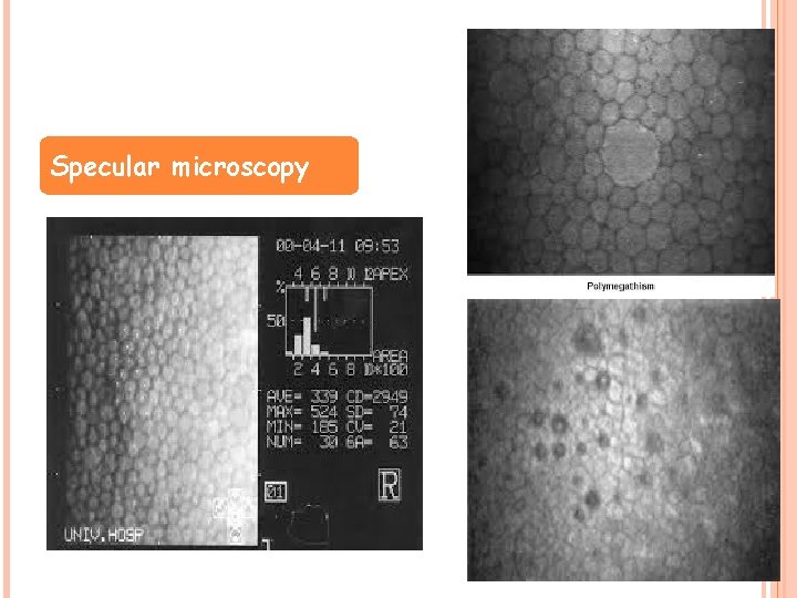 Specular microscopy 