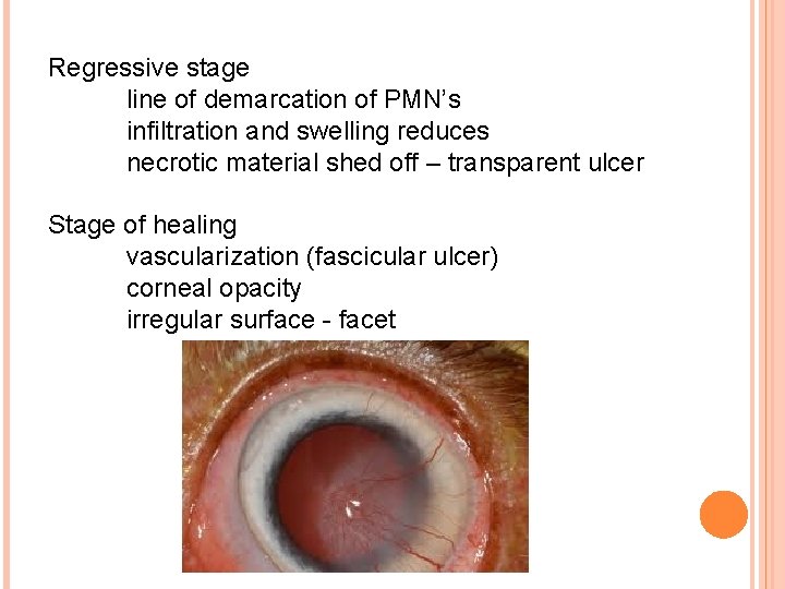 Regressive stage line of demarcation of PMN’s infiltration and swelling reduces necrotic material shed