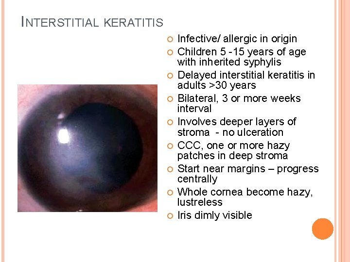 INTERSTITIAL KERATITIS Infective/ allergic in origin Children 5 -15 years of age with inherited