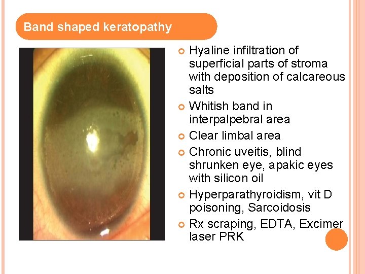 Band shaped keratopathy Hyaline infiltration of superficial parts of stroma with deposition of calcareous