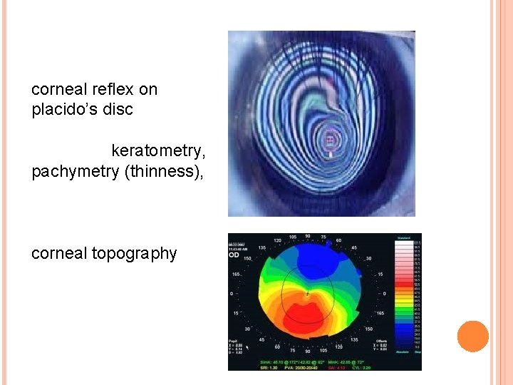 corneal reflex on placido’s disc keratometry, pachymetry (thinness), corneal topography 
