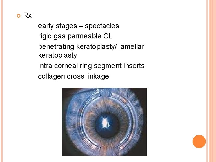  Rx early stages – spectacles rigid gas permeable CL penetrating keratoplasty/ lamellar keratoplasty