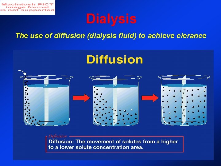 Dialysis The use of diffusion (dialysis fluid) to achieve clerance Dialysis The use of diffusion (dialysis fluid) to achieve clerance