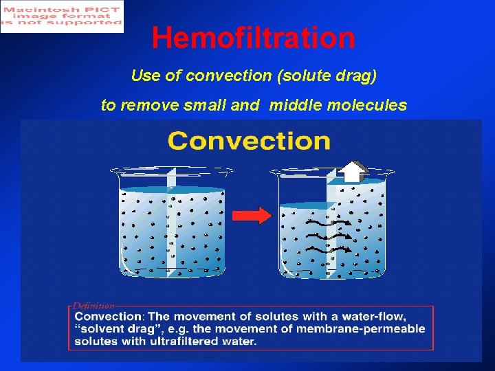 Hemofiltration Use of convection (solute drag) to remove small and middle molecules Hemofiltration Use of convection (solute drag) to remove small and middle molecules