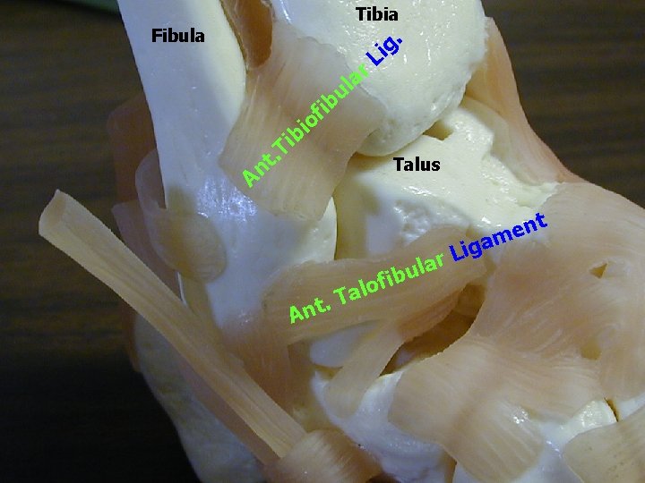 Tibia Fibula ar i b i l u b L i f o T Tibia Fibula ar i b i l u b L i f o T