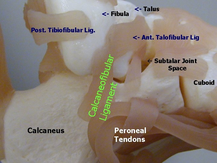 <- Fibula Post. Tibiofibular Lig. <- Talus Calc aneo Liga men fibular t <-