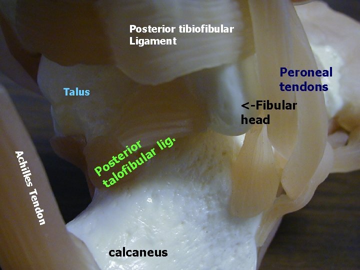 Posterior tibiofibular Ligament Peroneal tendons Talus <-Fibular head illes Ach or don Ten ri