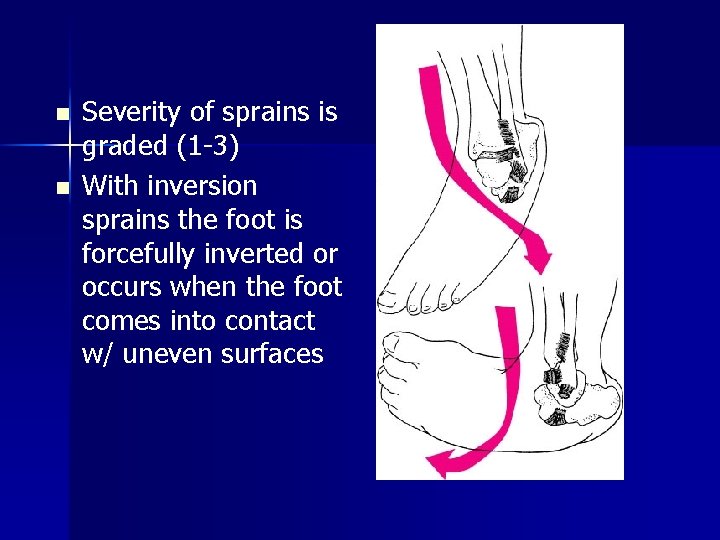 n n Severity of sprains is graded (1 -3) With inversion sprains the foot n n Severity of sprains is graded (1 -3) With inversion sprains the foot