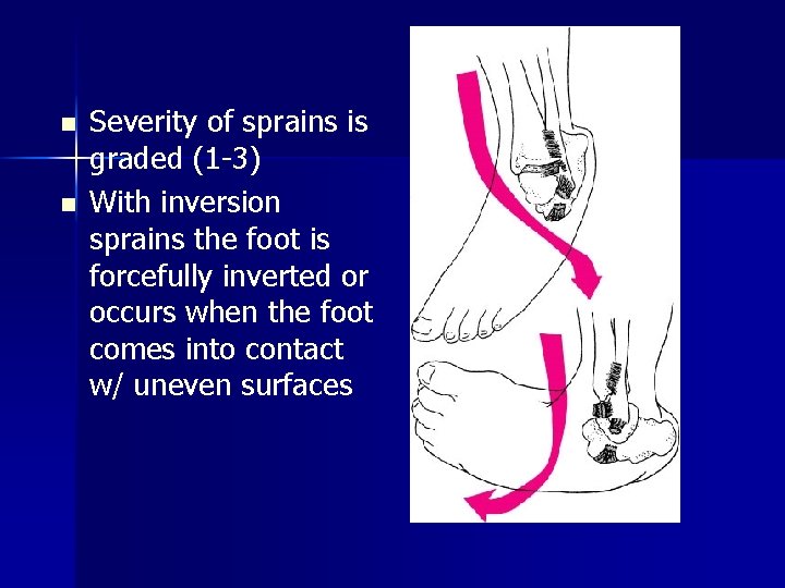 n n Severity of sprains is graded (1 -3) With inversion sprains the foot