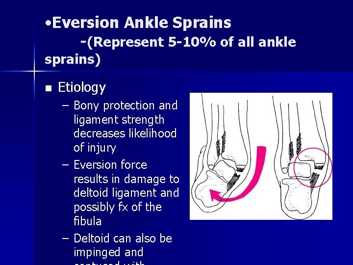 • Eversion Ankle Sprains -(Represent 5 -10% of all ankle sprains) n Etiology • Eversion Ankle Sprains -(Represent 5 -10% of all ankle sprains) n Etiology