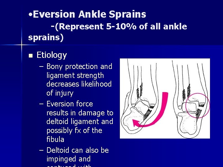  • Eversion Ankle Sprains -(Represent 5 -10% of all ankle sprains) n Etiology