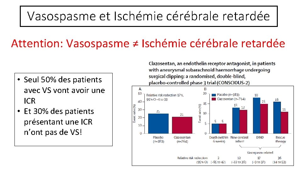 Vasospasme et Ischémie cérébrale retardée Attention: Vasospasme ≠ Ischémie cérébrale retardée • Seul 50%