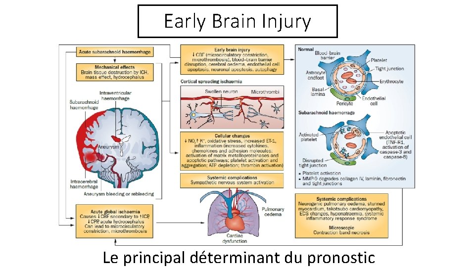 Early Brain Injury Le principal déterminant du pronostic 