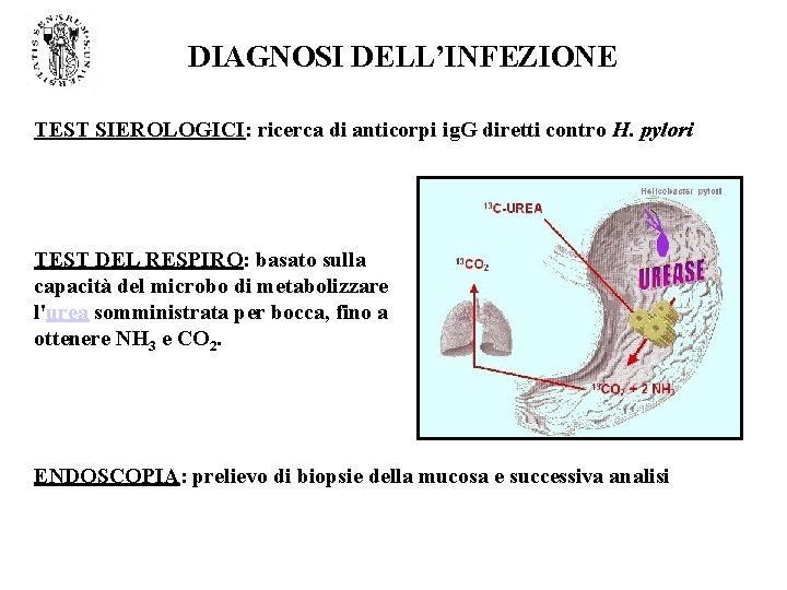 DIAGNOSI DELL’INFEZIONE TEST SIEROLOGICI: ricerca di anticorpi ig. G diretti contro H. pylori TEST DIAGNOSI DELL’INFEZIONE TEST SIEROLOGICI: ricerca di anticorpi ig. G diretti contro H. pylori TEST