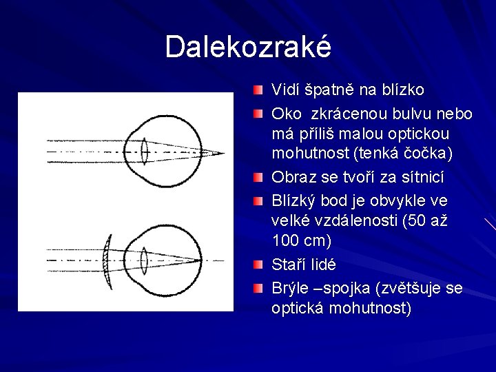 Dalekozraké Vidí špatně na blízko Oko zkrácenou bulvu nebo má příliš malou optickou mohutnost