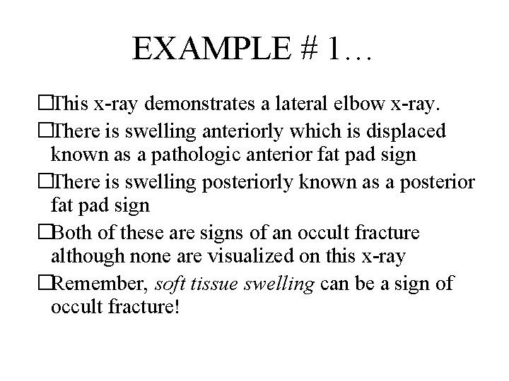 EXAMPLE # 1… �This x-ray demonstrates a lateral elbow x-ray. �There is swelling anteriorly