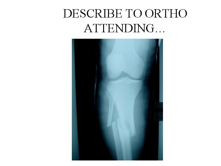 DESCRIBE TO ORTHO ATTENDING… 