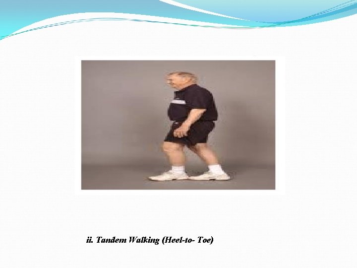 ii. Tandem Walking (Heel-to- Toe) ii. Tandem Walking (Heel-to- Toe)